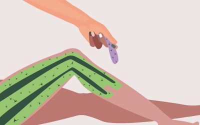 Sunvital Nişantaşı Lazer Epilasyonun Avantajları